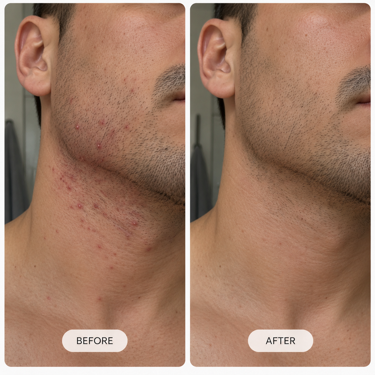 LUMORA™ Smoothing Solution Ingrown Hair Treatment