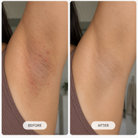LUMORA™ Smoothing Solution Ingrown Hair Treatment
