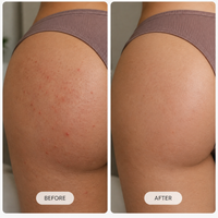 LUMORA™ Smoothing Solution Ingrown Hair Treatment